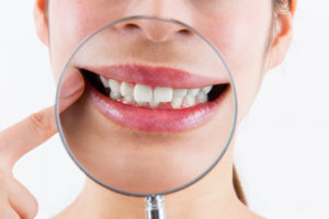 歯の根っこを覆う膜