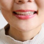 口元が出ている？～ロゴボってしっていますか？～