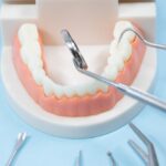 虫歯の進行止めのお薬！サホライドってなに？